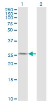 Western Blot: AK3 Antibody (1D2) [H00050808-M01]