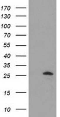 Western Blot: AK3 Antibody (OTI6G4) [NBP2-03154]