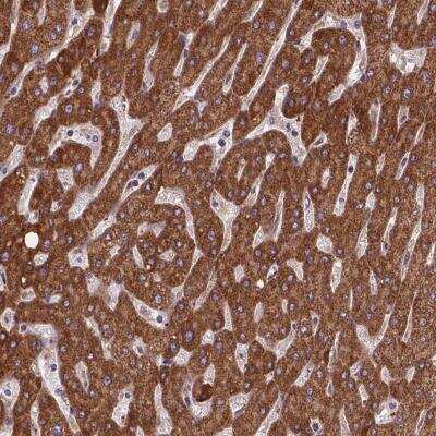 Immunohistochemistry-Paraffin: AK3 Antibody [NBP2-49393]