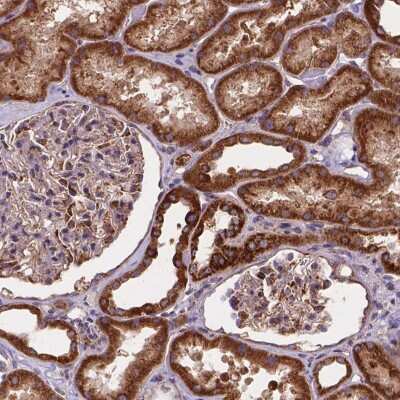 Immunohistochemistry-Paraffin: AK3 Antibody [NBP2-49393]