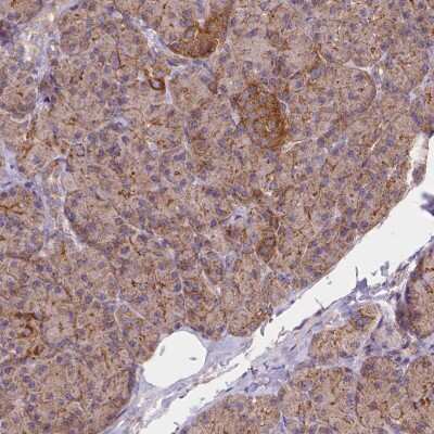 Immunohistochemistry-Paraffin: AK3 Antibody [NBP2-49393]