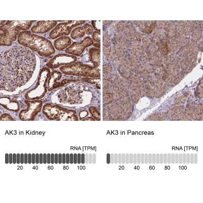 Immunohistochemistry-Paraffin: AK3 Antibody [NBP2-49393]