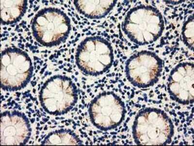 Immunohistochemistry: AK3 Antibody (OTI6G4) - Azide and BSA Free [NBP2-71874]