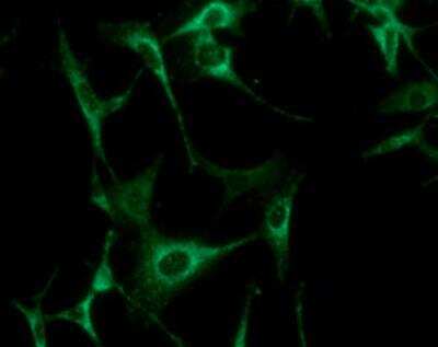 Immunocytochemistry/ Immunofluorescence: AK3 Antibody (SJB3-36) - BSA Free [NBP1-04261]