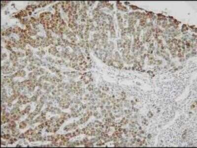 Immunohistochemistry-Paraffin: AK3 Antibody (SJB3-36) - BSA Free [NBP1-04261]