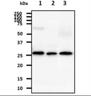 Western Blot: AK3 Antibody (SJB3-36)BSA Free [NBP1-04261]