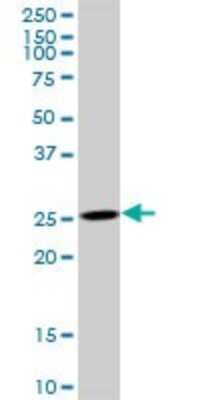 Western Blot: AK3 Antibody [H00050808-B01P]