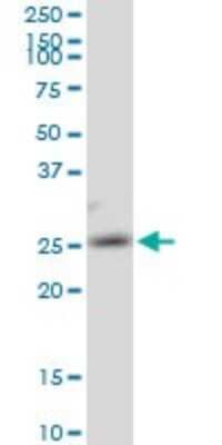 Western Blot: AK3 Antibody [H00050808-B01P]