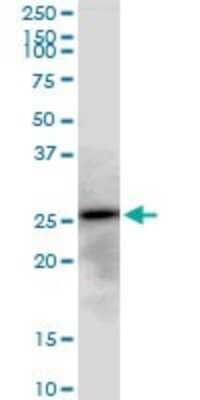 Western Blot: AK3 Antibody [H00050808-B01P]