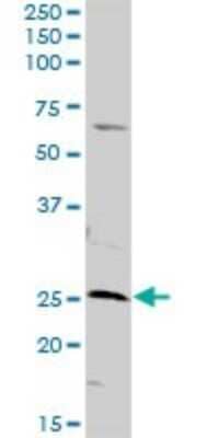 Western Blot: AK3 Antibody [H00050808-D01P]