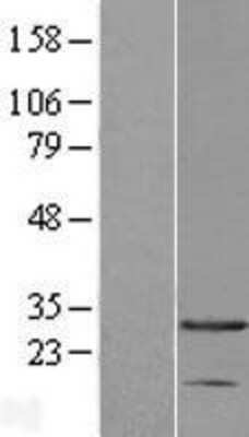 Western Blot: AK3 Overexpression Lysate [NBL1-07419]