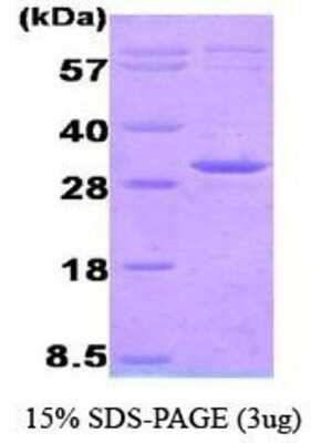 SDS-PAGE: Recombinant Human AK3 His Protein [NBC1-18396]