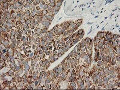 Immunohistochemistry-Paraffin: AK3L1 Antibody (OTI3B1) [NBP2-00827]