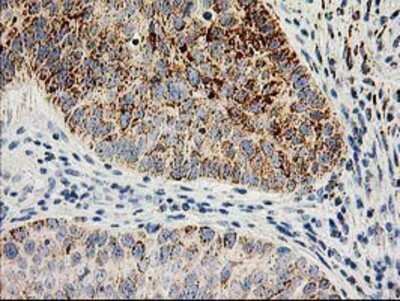 Immunohistochemistry-Paraffin: AK3L1 Antibody (OTI3B1) [NBP2-00827]