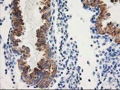 Immunohistochemistry-Paraffin: AK3L1 Antibody (OTI3B1) [NBP2-00827]