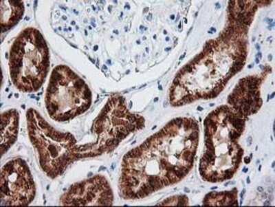 Immunohistochemistry-Paraffin: AK3L1 Antibody (OTI3B1) [NBP2-00827]