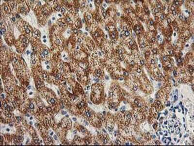 Immunohistochemistry-Paraffin: AK3L1 Antibody (OTI3B1) [NBP2-00827]