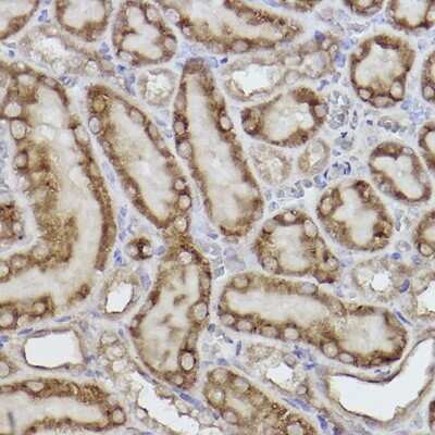 Immunohistochemistry-Paraffin: AK3L1 Antibody (9T5P1) [NBP3-16116]