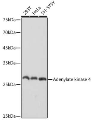 Western Blot: AK3L1 Antibody (9T5P1) [NBP3-16116]