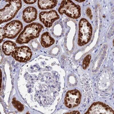 Immunohistochemistry: AK3L1 Antibody [NBP2-48773]