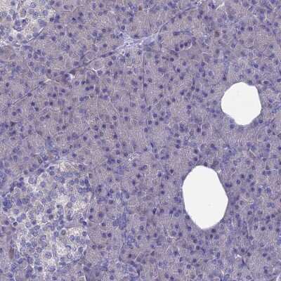 Immunohistochemistry-Paraffin: AK3L1 Antibody [NBP2-48773]