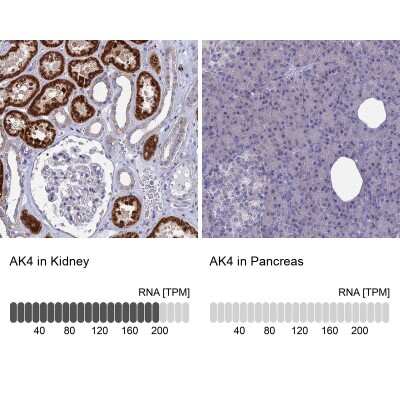 Immunohistochemistry-Paraffin: AK3L1 Antibody [NBP2-48773]