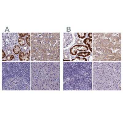Immunohistochemistry-Paraffin: AK3L1 Antibody [NBP2-48773]