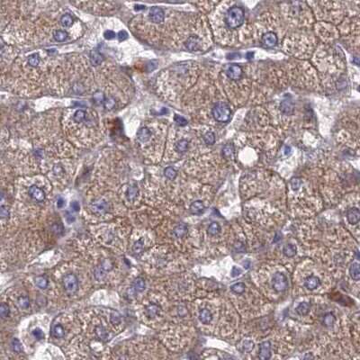 Immunohistochemistry-Paraffin: AK3L1 Antibody [NBP2-48773]