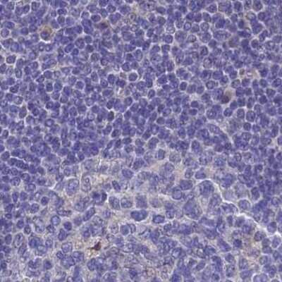 Immunohistochemistry-Paraffin: AK3L1 Antibody [NBP2-48773]
