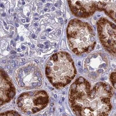 Immunohistochemistry-Paraffin: AK3L1 Antibody [NBP2-48773]