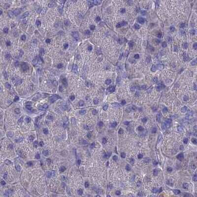 Immunohistochemistry-Paraffin: AK3L1 Antibody [NBP2-48773]