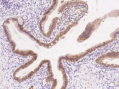 Immunohistochemistry-Paraffin: AK3L1 Antibody [NBP2-97592]