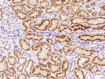 Immunohistochemistry-Paraffin: AK3L1 Antibody [NBP2-97592]