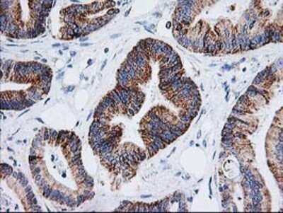 Immunohistochemistry: AK3L1 Antibody (OTI3B1) - Azide and BSA Free [NBP2-70129]