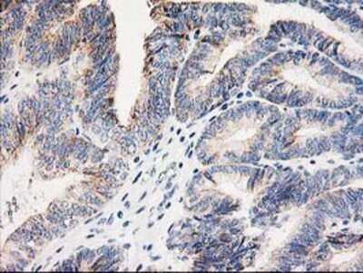 Immunohistochemistry: AK3L1 Antibody (OTI3B1) - Azide and BSA Free [NBP2-70129]