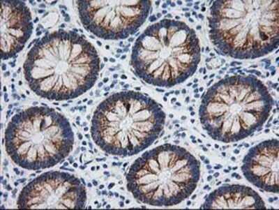 Immunohistochemistry: AK3L1 Antibody (OTI3B1) - Azide and BSA Free [NBP2-70129]