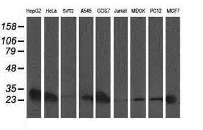 Western Blot: AK3L1 Antibody (OTI3B1)Azide and BSA Free [NBP2-70129]