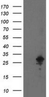 Western Blot: AK3L1 Antibody (OTI3B1)Azide and BSA Free [NBP2-70129]