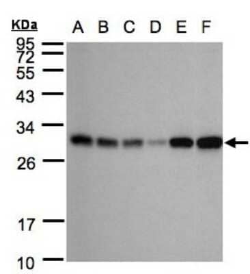 Western Blot: AK3L1 Antibody [NBP1-31462]