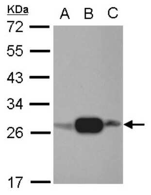 Western Blot: AK3L1 Antibody [NBP2-15317]