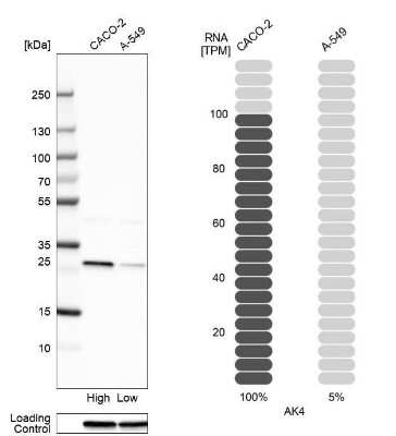 Western Blot: AK3L1 Antibody [NBP2-47553]