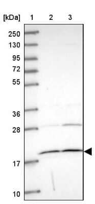 Western Blot: AK3L1 Antibody [NBP2-48773]