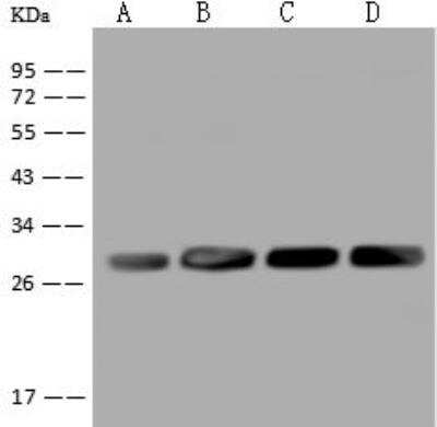 Western Blot: AK3L1 Antibody [NBP2-97592]