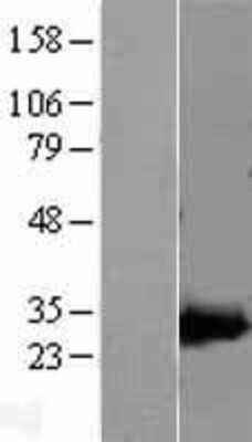 Western Blot: AK3L1 Overexpression Lysate [NBL1-07420]