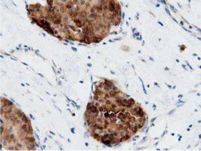 Immunohistochemistry-Paraffin: AK5 Antibody (OTI2F9) [NBP2-02978]