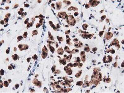 Immunohistochemistry-Paraffin: AK5 Antibody (OTI2F9) [NBP2-02978]
