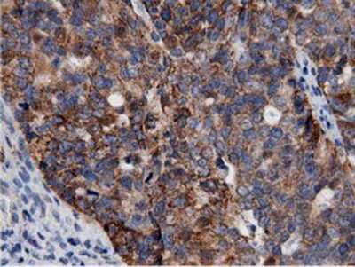 Immunohistochemistry-Paraffin: AK5 Antibody (OTI2F9) [NBP2-02978]