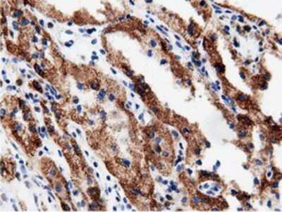 Immunohistochemistry-Paraffin: AK5 Antibody (OTI2F9) [NBP2-02978]