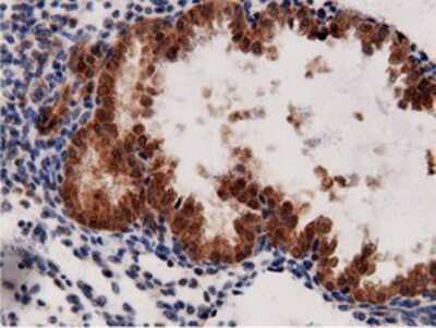 Immunohistochemistry-Paraffin: AK5 Antibody (OTI2F9) [NBP2-02978]