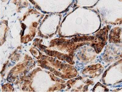 Immunohistochemistry-Paraffin: AK5 Antibody (OTI2F9) [NBP2-02978]